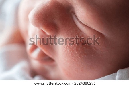 Pimples on the face of a newborn. Baby's adaptation to the environment. Royalty-Free Stock Photo #2324380295
