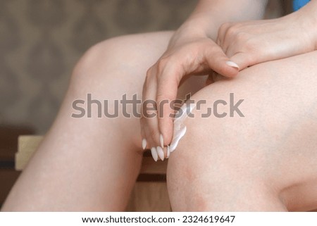 Woman applying ointment on knee for pain and swelling reduction. Leg injury treatment concept. Bruise, sprain, arthritis, overuse. Health care concept. High quality photo