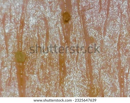 Human skin under the microscope Royalty-Free Stock Photo #2325647639