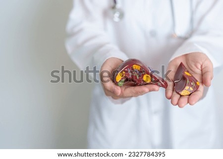 Doctor holding human Liver anatomy model. Liver cancer and Tumor, Jaundice, Viral Hepatitis A, B, C, D, E, Cirrhosis, Failure, Enlarged, Hepatic Encephalopathy, Ascites Fluid in Belly and health Royalty-Free Stock Photo #2327784395