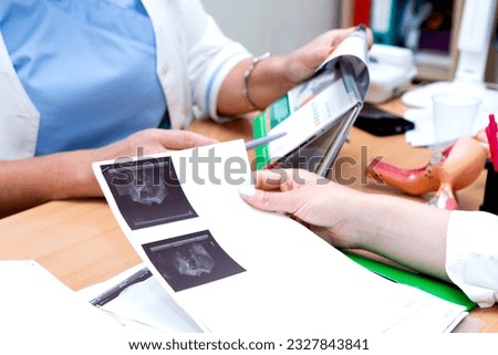 The gynecologist looks at the ultrasound. Reproductive medicine, conception of a child