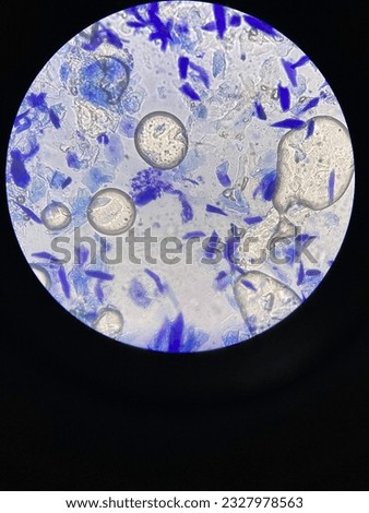 results of skin examination with simple staining under a microscope. Inflammatory cells and cell debris are seen. Royalty-Free Stock Photo #2327978563