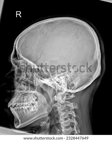 Detailed X-ray of the human skull showing intricate bone structure and dental alignment Royalty-Free Stock Photo #2328447649