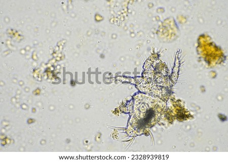 soil microbes organisms in a soil and compost sample, fungus and fungi and under the microscope in regenerative agriculture. in australia.

 Royalty-Free Stock Photo #2328939819