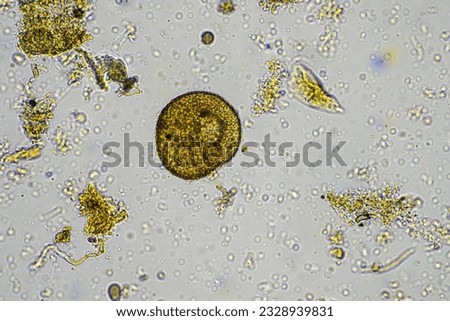 soil sample containing soil biology, with bacteria, fungi, amoeba, flagellate, and arcella, on a sustainable agricultural farm in australia  Royalty-Free Stock Photo #2328939831