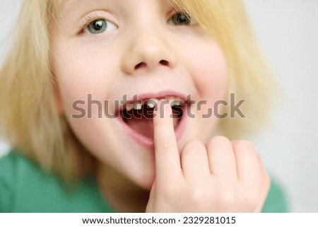 Portrait of boy shaking wobbly milk tooth in open mouth before it changes to the molar. Stages of growing up a child. Health care and dental hygiene for baby. Childhood Royalty-Free Stock Photo #2329281015