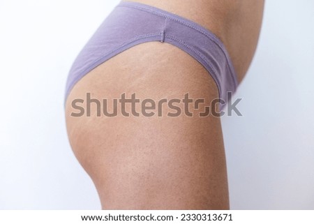 Female body with stretch marks on the buttocks, stretch marks on the skin after losing weight, postpartum skin changes