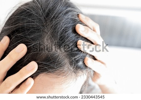 Premature gray hair problem,stressed asian young woman with hair loss,thyroid or autoimmune disorders,alopecia areata,deficiency of vitamins,concerned about graying hair,health care,medical concept Royalty-Free Stock Photo #2330443545