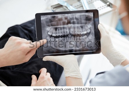 Close up woman dentist holding patient mouth digital film.Female doctor showing patient oral scan