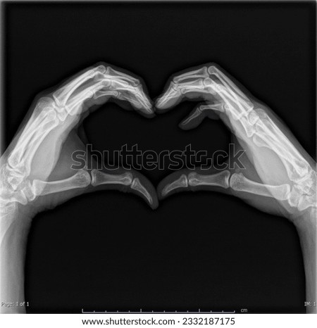 This is x-ray pictures heart hand