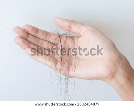 Asian woman is presentation hair loss problem Royalty-Free Stock Photo #2332454879