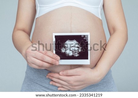 Young pregnant woman holding her ultrasound in the last trimester of pregnancy