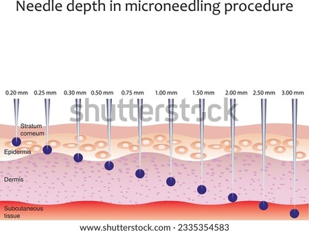 Needle depth in micro needling treatment. Skin layers and needles injection. Royalty-Free Stock Photo #2335354583