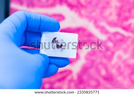 Scientist wear blue glove holding parafin human tissue block and out of focus computer monitor show glandular image.Biopsy in the laboratory of cancer research.Medical patholology and cytology concept Royalty-Free Stock Photo #2335835771