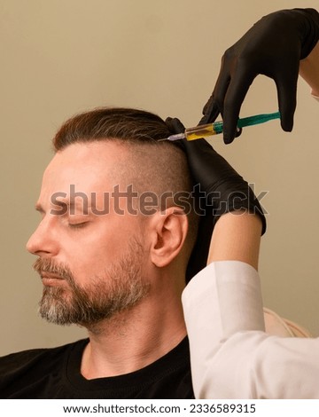 Esthetician uses thin needle to inject Platelet-Rich Plasma in scalp. Plasma lift treatment. Doctor trichologist making injections PRP application in man's head Royalty-Free Stock Photo #2336589315