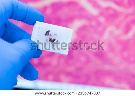 Scientist wear blue glove holding parafin human tissue block and out of focus computer monitor show glandular image.Biopsy in the laboratory of cancer research.Medical patholology and cytology concept Royalty-Free Stock Photo #2336947837