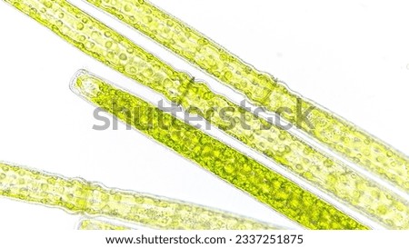 Algae blooming under microscope. The species are Pleurotaenium sp and Closterium sp. Live cell. 760x magnification. Selective focus image Royalty-Free Stock Photo #2337251875