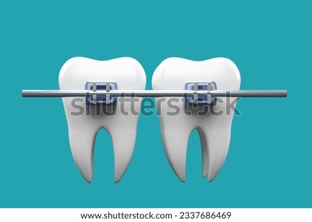 Teeth braces. Teeth alignment. teeth with braces . 3d render. Royalty-Free Stock Photo #2337686469