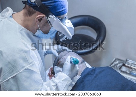 Hair transplant. Surgeons in the operating room carry out hair transplant surgery. Royalty-Free Stock Photo #2337863863