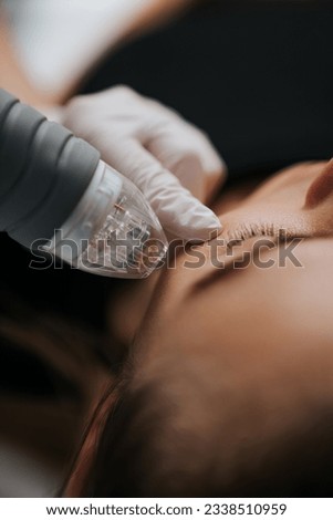 Microneedle RF lifting in a beauty salon. Big plan. High quality photo Royalty-Free Stock Photo #2338510959