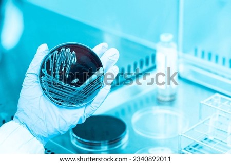 Scientist hand wearing blue gloves hold agar plate for diagnosis bacterial or microorganism in the hood at laboratory. Selective petri dish with colonies of bacteria