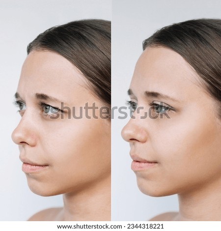 Young caucasian woman's face with drooping upper eyelid before and after blepharoplasty on a gray background. The result of plastic surgery. Changing the shape, cut of the eyes Royalty-Free Stock Photo #2344318221