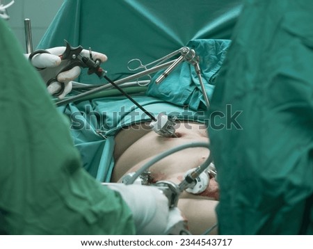 Surgeon team during bariatric surgery with laparoscopic instruments in the operating room. Royalty-Free Stock Photo #2344543717
