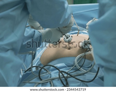 Surgeon team during bariatric surgery with laparoscopic instruments in the operating room. Royalty-Free Stock Photo #2344543719