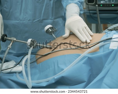 Surgeon team during bariatric surgery with laparoscopic instruments in the operating room. Royalty-Free Stock Photo #2344543721