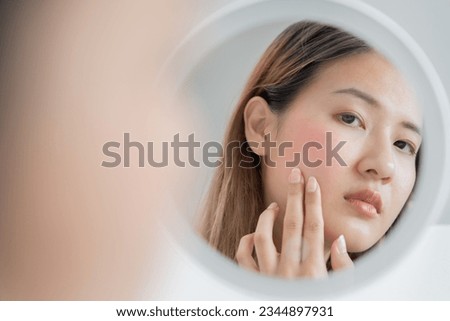 Woman worried about face Dermatology, rosacea dermatitis, allergic steroids, sensitive skin, red face from sunburn, acne, dry skin, large pores ,rash face, dull, freckles, wrinkle, skin problem Royalty-Free Stock Photo #2344897931