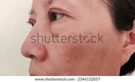 close up the Wrinkle and dull skin, ptosis and flabby skin beside the eyelid, swelling and bag under the eye, dark spots and blemish, freckles and aesthetic on the face,health care and beauty concept. Royalty-Free Stock Photo #2346132057