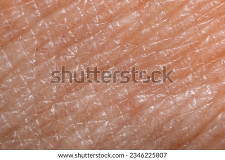 Skin diseases concept. macrophotograph of human skin under microscope, manified 5x. Medicine and dermatology concept. Details of human skin. Royalty-Free Stock Photo #2346225807