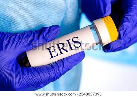 New infectious Eris variant of covid disease (EG.5) sample in lab tube in the scientist hand in blue medical glove on light background Royalty-Free Stock Photo #2348057395