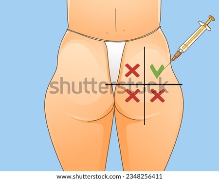 Beauty injections. Non-surgical correction. Save area. Sciatic nerve. Healthcare illustration. Beauty illustration. Vector illustration.  Royalty-Free Stock Photo #2348256411