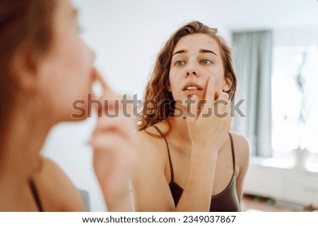 Close-up of a young woman looking at pimples in the mirror. Beautiful woman with acne problem skin checks dry face skin. Red spots, rash, acne. Skin treatment. Royalty-Free Stock Photo #2349037867