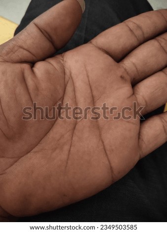 photo of the palm of an adult man on the left with a line in the shape of the alphabet letter M.