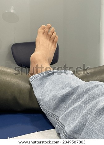 Man's foot lying on a medical clinic bed with ankle malformation. Body deformity, swollen. High quality photo Royalty-Free Stock Photo #2349587805