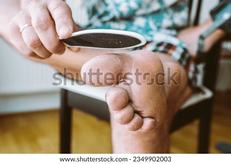 man makes peeling skin legs. Removes dry, cracked skin on soles feet. Cleansing, peeling old, dry skin with signs fungus