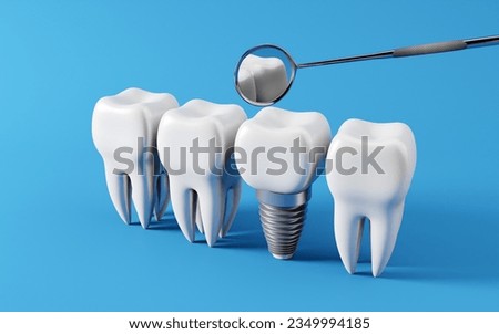 Dental teeth implants and Healthy white tooths, dentist mirror, Oral health and dental inspection teeth. Medical dentist tool, children healthcare