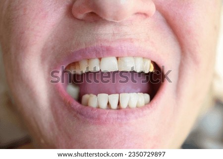 Close-up photo of natural looking teeth of a aged woman.