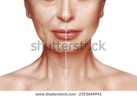 The lower part of the face and décolleté of a woman after 50 years of age, before and after face-building, creams, lotions . Close-up isolated on white Royalty-Free Stock Photo #2353644941