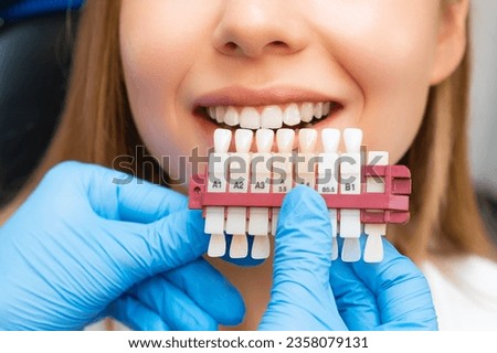 Set of implants with various shades of tone for whitening of teeth and perfect woman smile.  Royalty-Free Stock Photo #2358079131