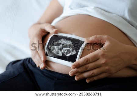 Pregnant woman holding an ultrasound image of the baby. Close-up of pregnant belly and ultrasound photography in mother's hands. Untied and healthy pregnancy concept