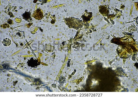 soil microorganisms close up under the microscope. in a soil samlple from a farm Royalty-Free Stock Photo #2358728727