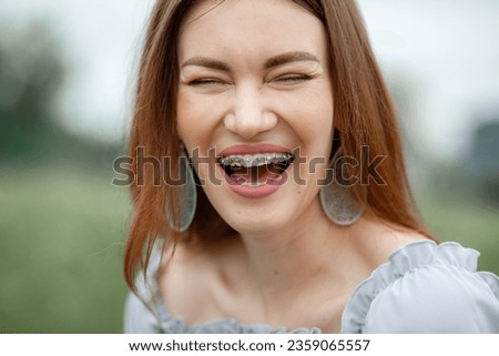 The smile of a young and beautiful girl with braces on her white teeth. Straightening of crooked teeth with the help of a bracket system. Malocclusion. Dental care. Smooth teeth and a beautiful smile Royalty-Free Stock Photo #2359065557