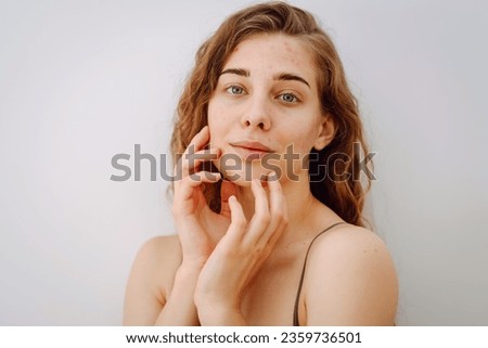 Close-up portrait of a beautiful woman without makeup with imperfect skin. Acne skin. Natural beauty. Medicine and cosmetology. Royalty-Free Stock Photo #2359736501