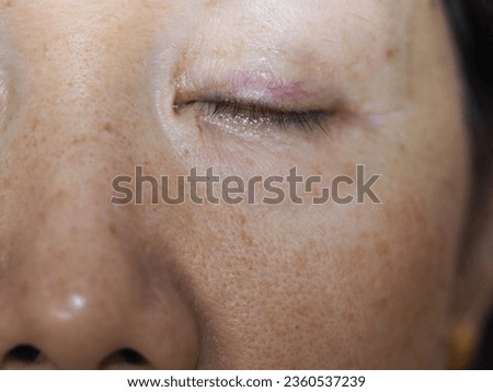 Older skin becomes too lax and falls or wrinkles during the natural aging process: Loss of firmness in the skin muscles and tissues around the eye can cause the baggy look Royalty-Free Stock Photo #2360537239