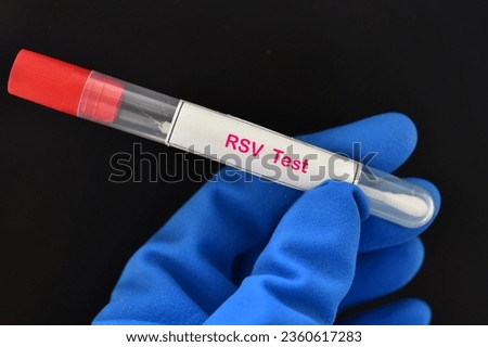 Nasopharyngeal swab from patient for respiratory syncytial virus (RSV) test  Royalty-Free Stock Photo #2360617283