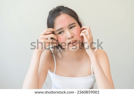 Dermatology, scratch asian young woman looking at mirror, expression worry and itch, itchy allergy or allergic sensitive reaction, red spot or rash on her face. Beauty care from skin problem treatment Royalty-Free Stock Photo #2360859001