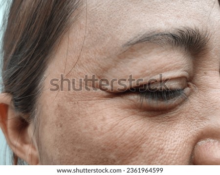 Facial skin problems of freckles, dark spots and wrinkles on the faces of middle-aged Asain women stressed expression, frowning, Dry and rough skin, Isolated on white background and concept of healthy Royalty-Free Stock Photo #2361964599